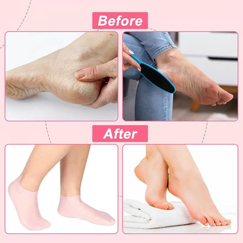 1 Pair Silicone socks